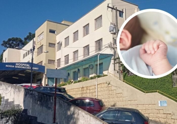 bebê queimado não foi atendido em capinzal